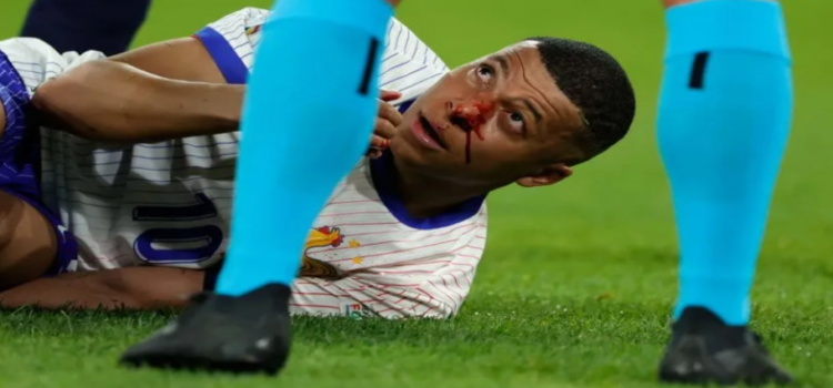 Kylian Mbappé jugará con máscara en la Eurocopa 2024; no será operado tras su fractura de nariz