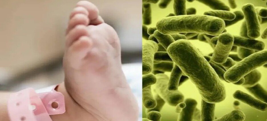 Detectan 4,000 infecciones asociadas a la atención médica en el Edomex