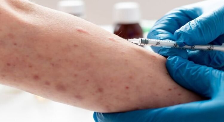 Reportan primeros 3 casos de sarampión en Edomex Reportan primeros 3 casos de sarampión en Edomex