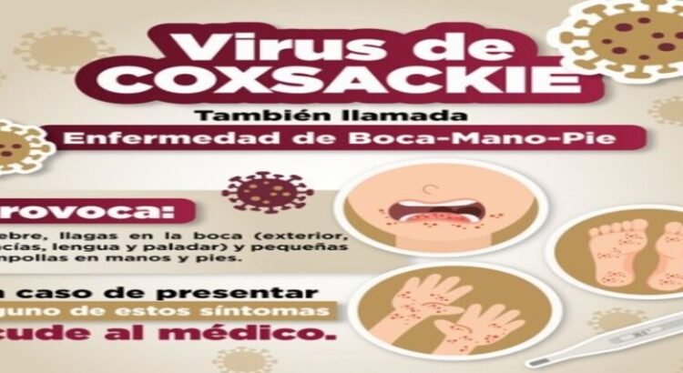Emiten recomendaciones por virus Coxsackie en Edomex Emiten recomendaciones por virus Coxsackie en Edomex