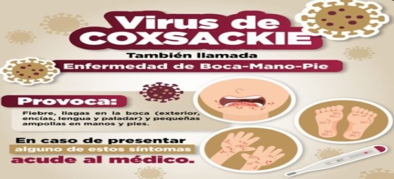 Emiten recomendaciones por virus Coxsackie en Edomex