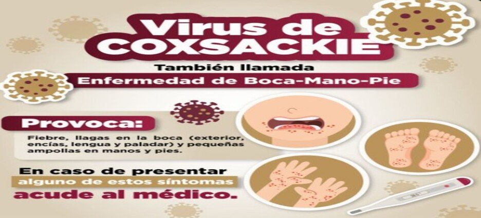 Emiten recomendaciones por virus Coxsackie en Edomex